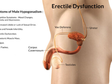 erectile-dysfunction-