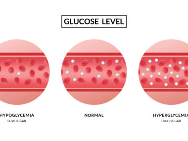 Hypoglycemia