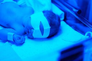 Newborn baby phototherapy for jaundice