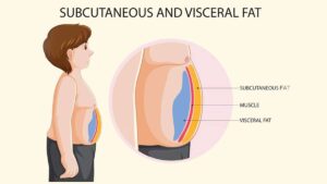 Visceral fat