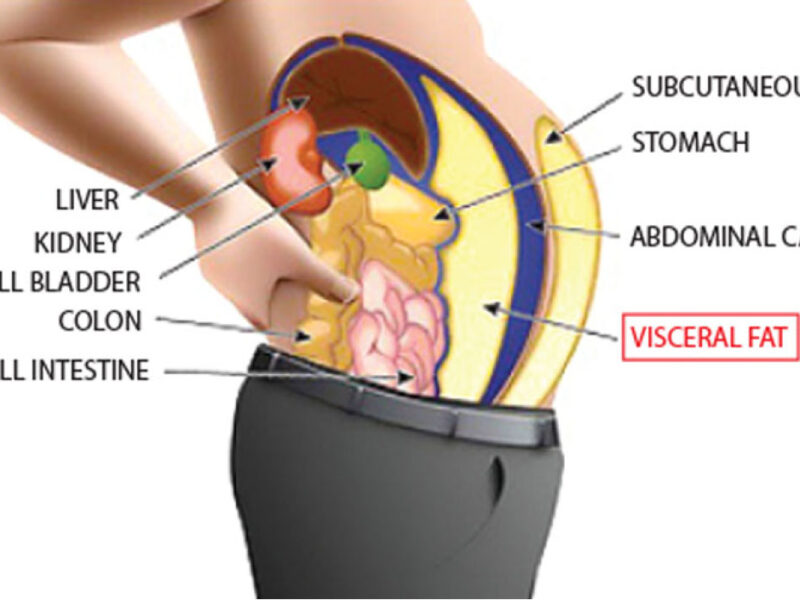 Visceral fat